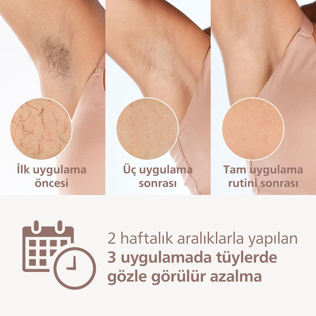 Philips Lumea 9900 Serisi BRI953/01 IPL Tüy Alma Cihazı - SkinAI, Vücut/Yüz/Bikini, 3 Başlık + Çanta - Kullanım Görseli